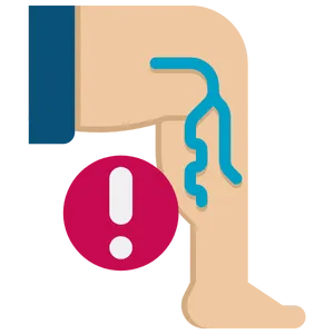 Azione emolliente Varicolift